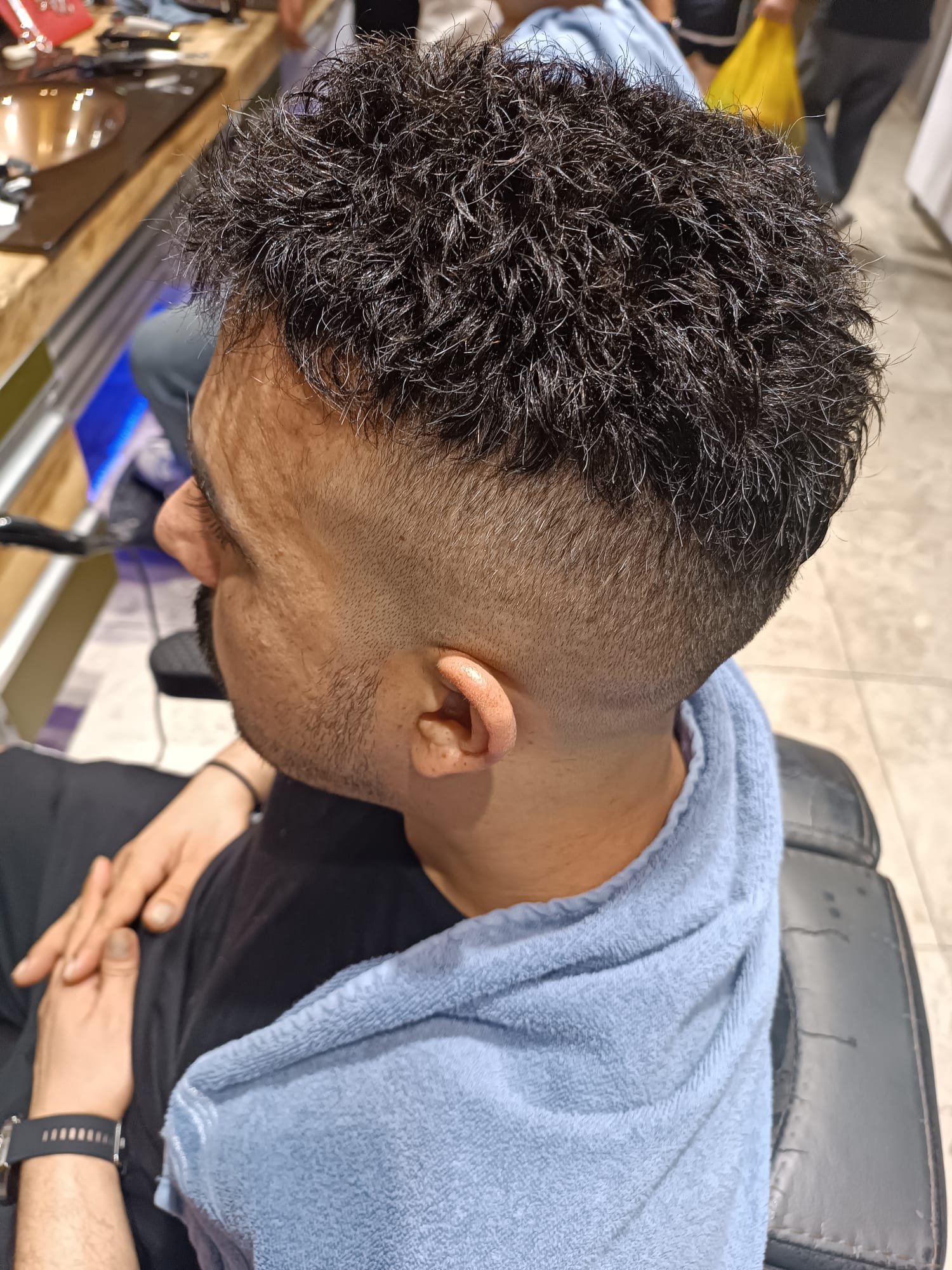 Sonrası — Eko Hair protez saç